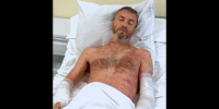 Дачник из Подмосковья взялся вручную косить борщевик и столкнулся с жуткими последствиями - Chehov-Vid.Ru